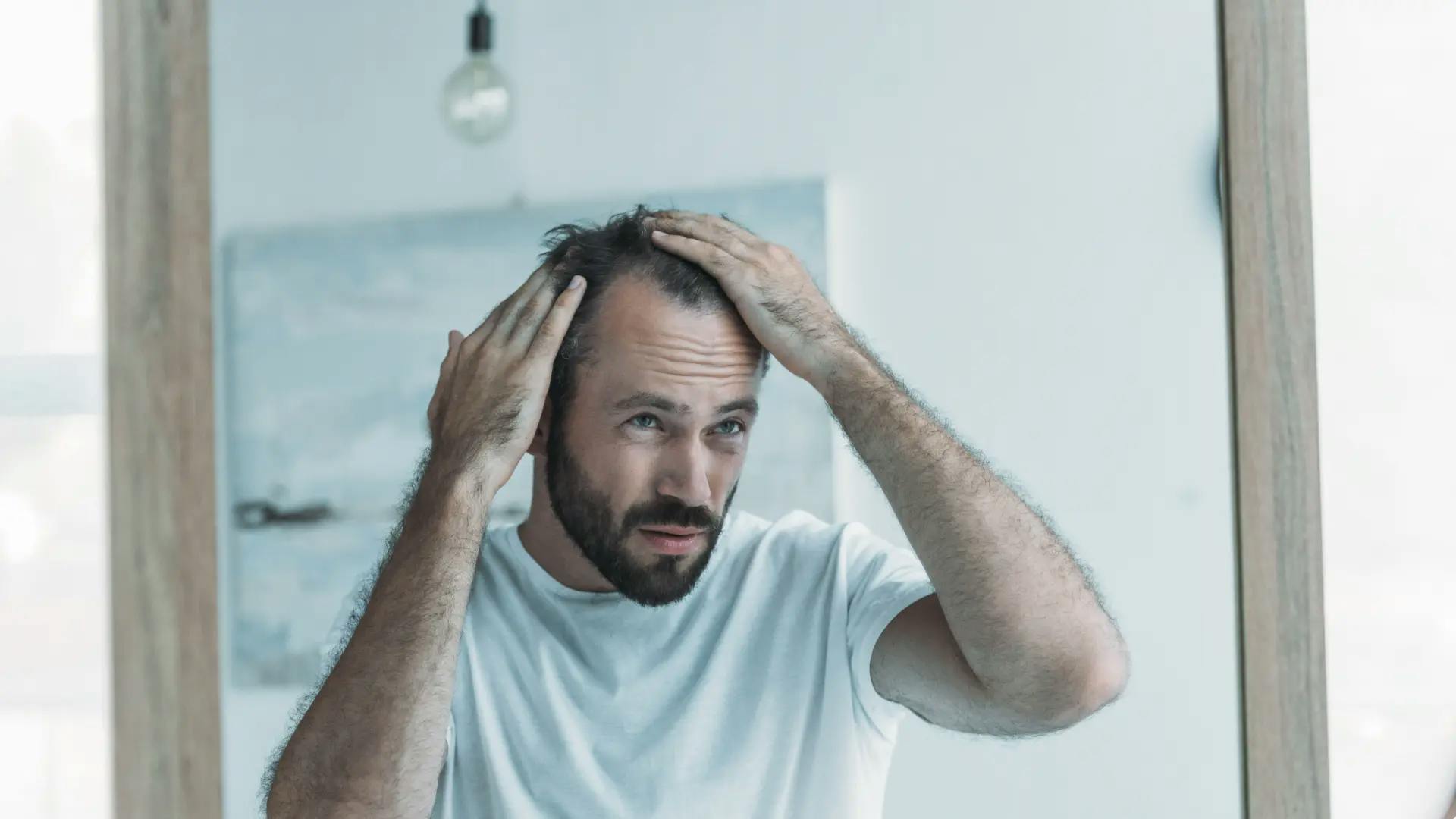 Căderea părului la bărbați. Cauze și mituri